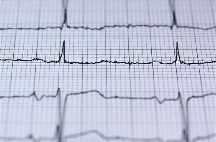 ECG monitoring equipment