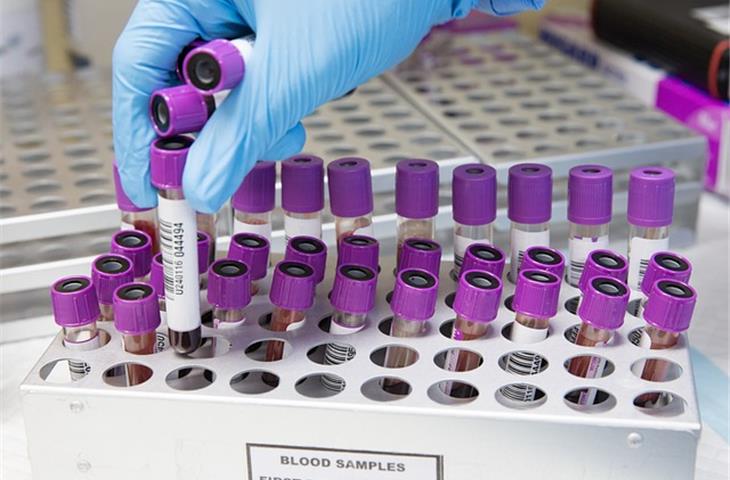 Why ECT Test Sample Papers Are Essential for Success