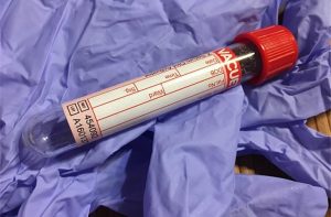 Essential Aspects of Needle Penetration Test Equipment