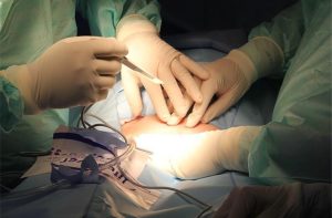 The Essential Role of Surgical Instruments in Bone Surgery